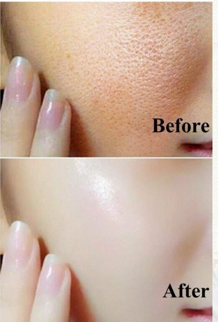 How to achieve Korean glass skin